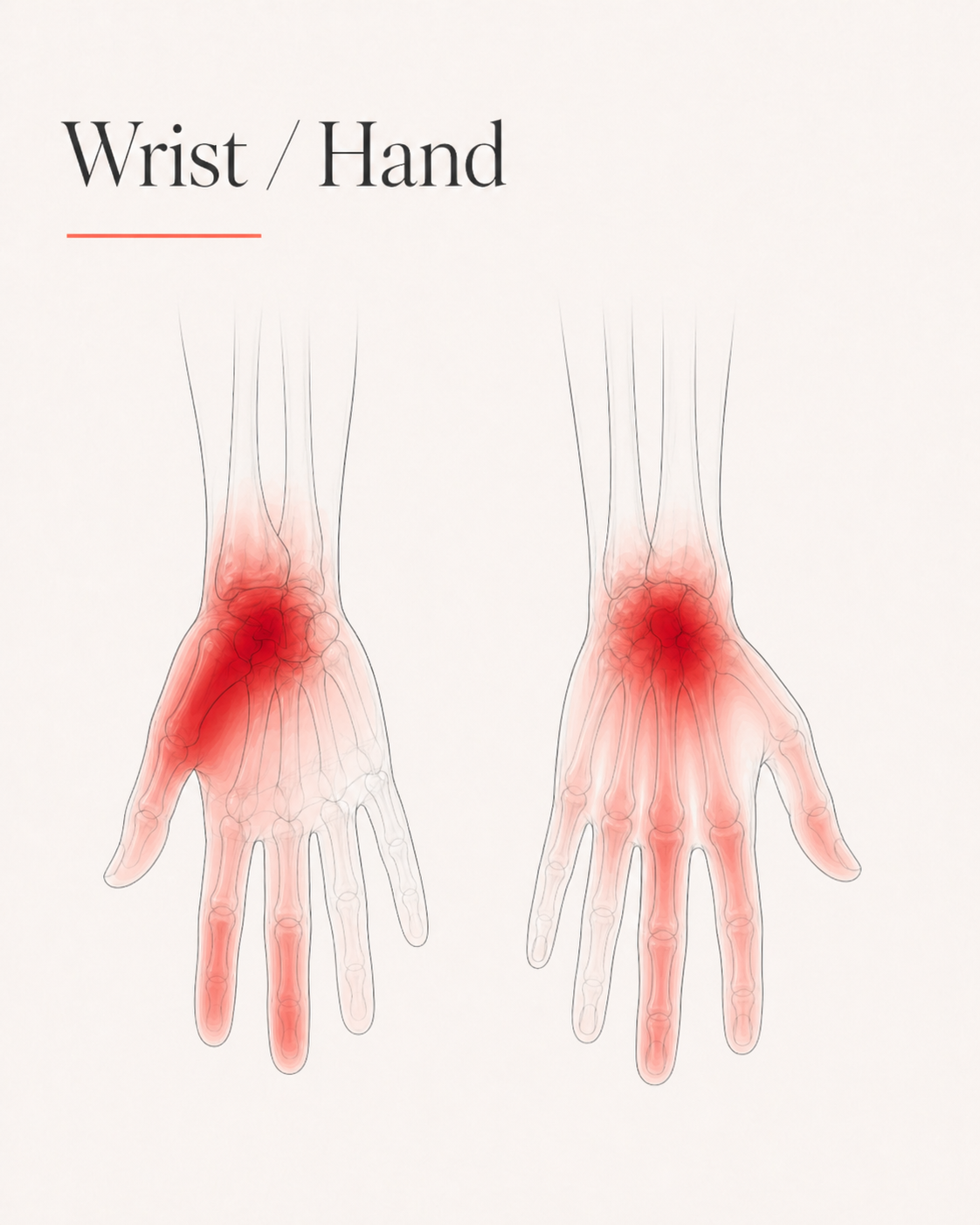 Wrist and Hand pain pattern
